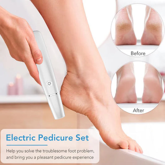 🔥Women's Day 70% Off🌸Electric Feet Callus Remover✨Smooth feet. In minutes. Guaranteed.