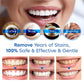 😁Buy 1 Get 1 Free🦷Teeth Whitening Essence🌿✨Your teeth DESERVE the best💪
