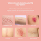 🏆Buy 2 Get 2 Free🔥Silicone Collagen Sheets For Scars & Wrinkles