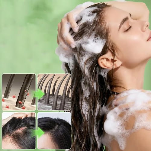 🌿The Weightless Wonder: How This Gentle Foam Formula Is Giving Women Back Their Hair Confidence