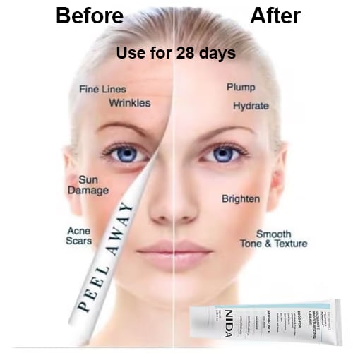 ⏳LAST DAY SPECIAL PRICE: ￡7.99!!🎉💝NIDA Youthful Formula Ultimate Moisturizing Cream