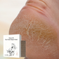 ⏰Christmas SALE 50% OFF🔥 Horse Oil Hand & Feet Repair Patch✨ Intensive Hydration for Dry Cracked Skin, Long-Lasting Relief