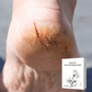 ⏰Christmas SALE 50% OFF🔥 Horse Oil Hand & Feet Repair Patch✨ Intensive Hydration for Dry Cracked Skin, Long-Lasting Relief