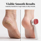 🦶✨ 50% OFF! Double-Sided Foot Scraper – Smooth Feet in Minutes! 🔥
